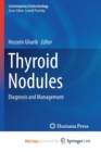 Image for Thyroid Nodules