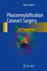 Image for Phacoemulsification Cataract Surgery