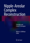 Image for Nipple-Areolar Complex Reconstruction