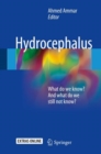 Image for Hydrocephalus: What do we know? And what do we still not know?