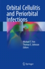 Image for Orbital Cellulitis and Periorbital Infections