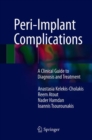 Image for Peri-Implant Complications : A Clinical Guide to Diagnosis and Treatment