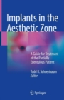 Image for Implants in the Aesthetic Zone : A Guide for Treatment of the Partially Edentulous Patient