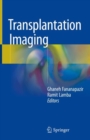 Image for Transplantation Imaging