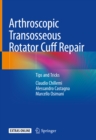 Image for Arthroscopic transosseous rotator cuff repair: tips and tricks