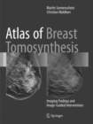 Image for Atlas of Breast Tomosynthesis