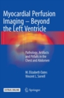 Image for Myocardial Perfusion Imaging - Beyond the Left Ventricle
