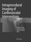Image for Intraprocedural Imaging of Cardiovascular Interventions