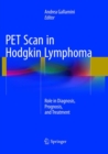 Image for PET Scan in Hodgkin Lymphoma