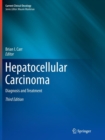 Image for Hepatocellular Carcinoma : Diagnosis and Treatment