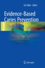 Image for Evidence-Based Caries Prevention