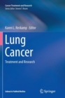 Image for Lung Cancer : Treatment and Research
