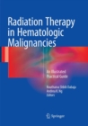 Image for Radiation Therapy in Hematologic Malignancies