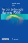 Image for Per Oral Endoscopic Myotomy (POEM)