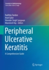 Image for Peripheral Ulcerative Keratitis