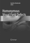 Image for Homonymous Visual Field Defects