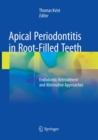 Image for Apical Periodontitis in Root-Filled Teeth : Endodontic Retreatment and Alternative Approaches