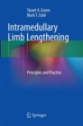 Image for Intramedullary Limb Lengthening