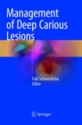 Image for Management of Deep Carious Lesions
