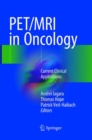 Image for PET/MRI in Oncology