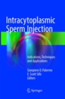 Image for Intracytoplasmic Sperm Injection
