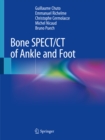 Image for Bone SPECT/CT of Ankle and Foot