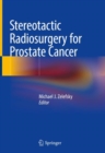 Image for Stereotactic Radiosurgery for Prostate Cancer