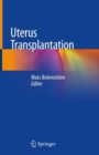 Image for Uterus Transplantation