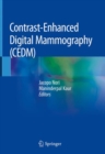 Image for Contrast-Enhanced Digital Mammography (CEDM)