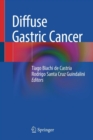 Image for Diffuse Gastric Cancer