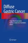 Image for Diffuse gastric cancer