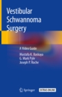 Image for Vestibular schwannoma surgery: a video guide