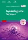 Image for Gynakologische Tumoren.