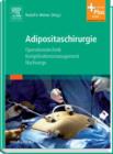 Image for Adipositaschirurgie: Operationstechnik - Komplikationsmanagement - Nachsorge