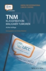 Image for Tnm: Klassifikation maligner Tumoren
