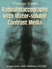 Image for Radiculosaccography with Water-soluble Contrast Media
