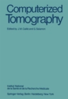 Image for Computerized Tomography
