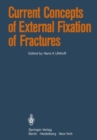 Image for Current Concepts of External Fixation of Fractures