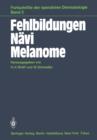 Image for Fehlbildungen Navi Melanome