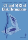 Image for Computed Tomography and Magnetic Resonance Imaging of Disc Herniations