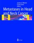 Image for Metastases in Head and Neck Cancer