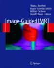 Image for Image Guided IMRT