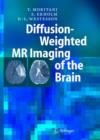 Image for Diffusion-Weighted Mr Imaging of the Brain
