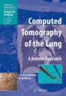 Image for Computed tomography of the lung  : a pattern approach