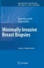 Image for Minimally Invasive Breast Biopsies