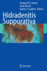 Image for Hidradenitis Suppurativa