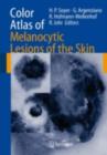 Image for Color atlas of melanocytic lesions of the skin