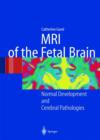 Image for MR imaging of the fetal brain  : normal development and cerebral pathologies