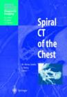 Image for Spiral CT of the Chest