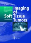 Image for Imaging of Soft Tissue Tumors